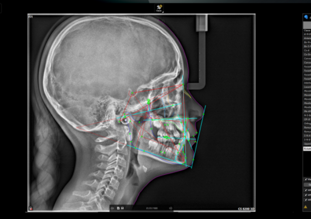 Qualité diagnostique : A quoi sert de personnaliser son  « format diagnostic » ?