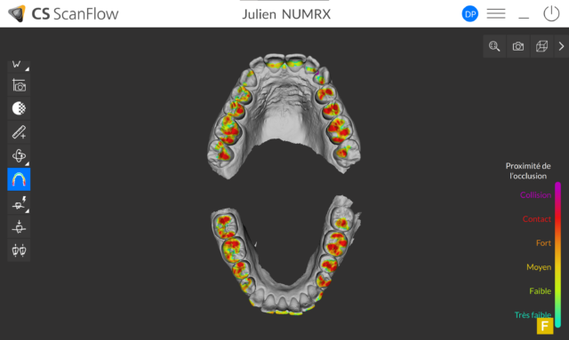 Orthodontie Numérique NUM RX