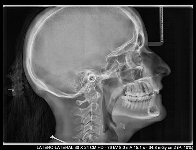 Orthodontie Numérique - NUM RX