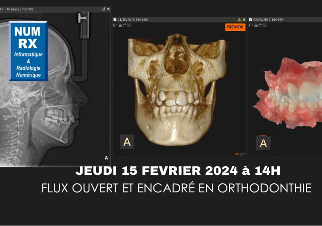 Spécial ORTHO : FLUX OUVERT ET ENCADRE en ORTHODONTIE